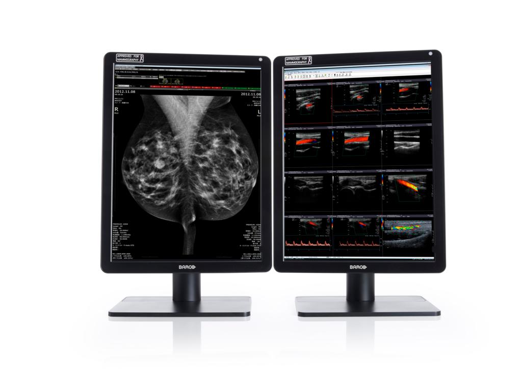Медицинский сверхъяркий цветной дисплей Barco MDNC-6121 — изображение 1